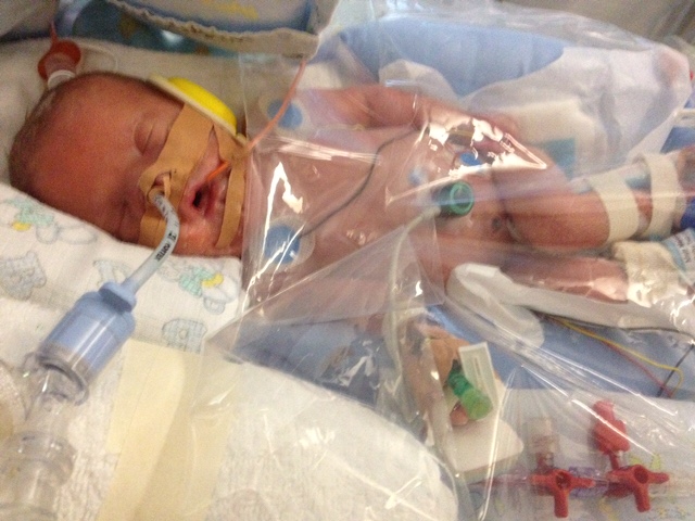 premature baby